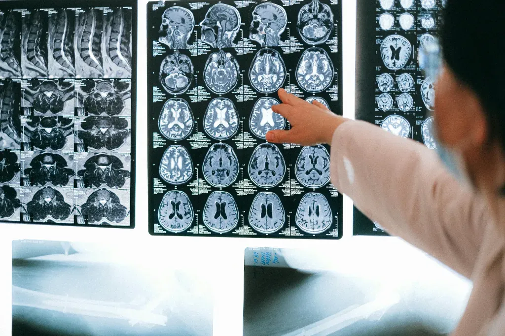 Teleradiologia 